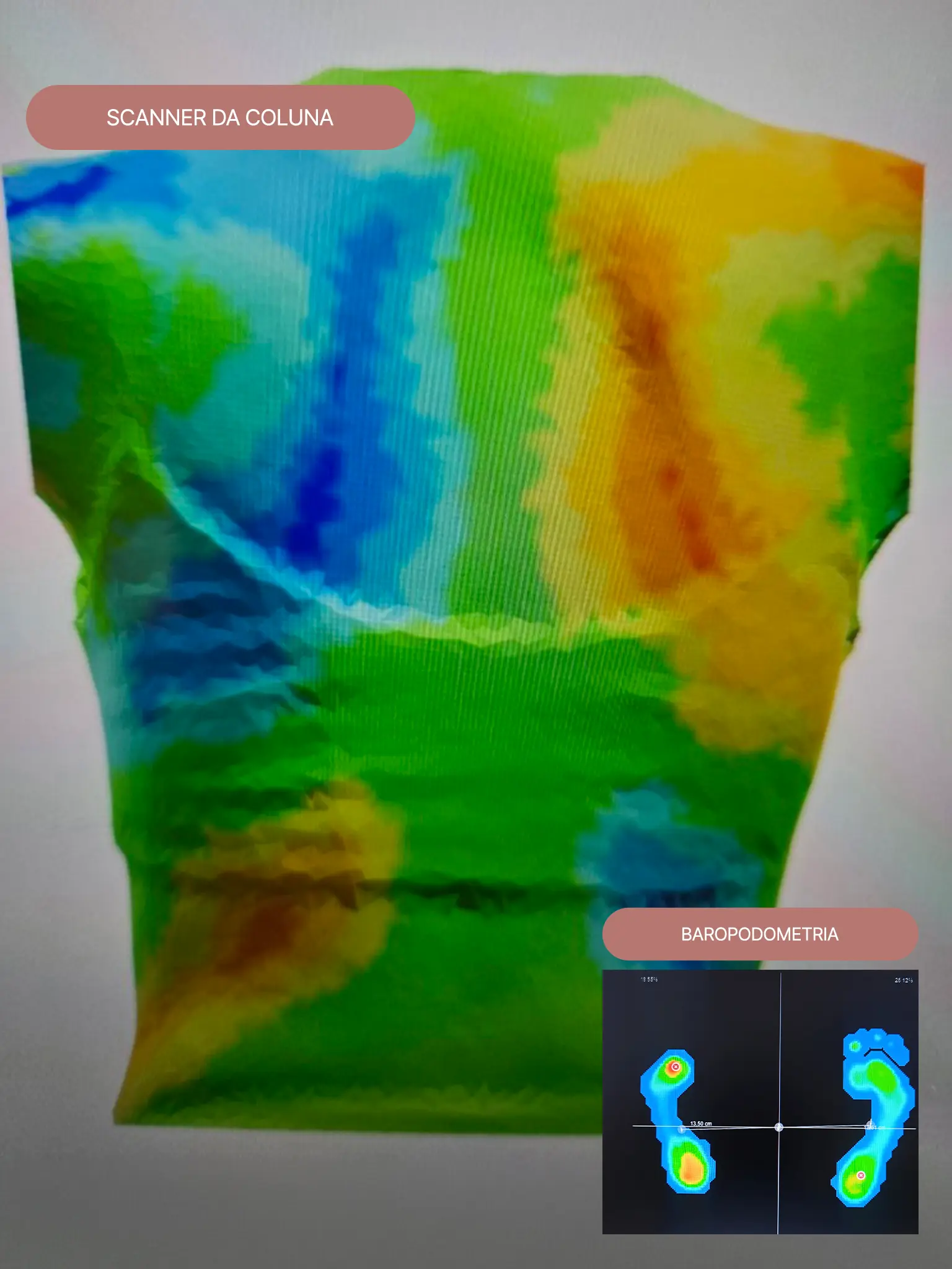 Scanner postural